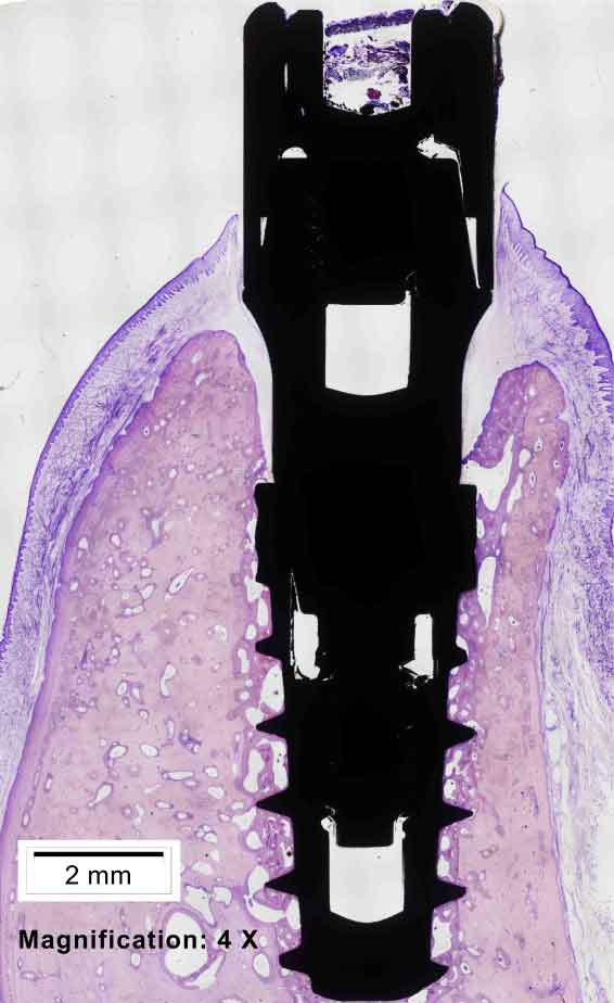 galimplant-histologica-implante