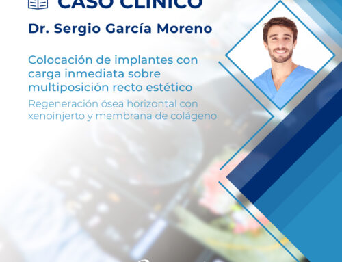Clinical case | Dr. Sergio García Moreno