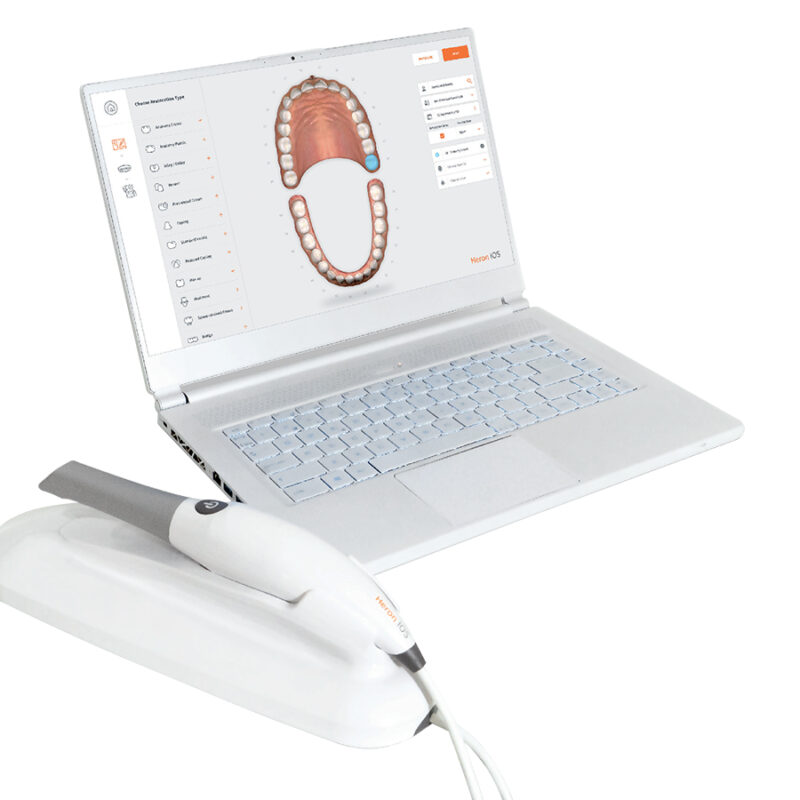 Escáner intraoral HERON IOS Galimplant