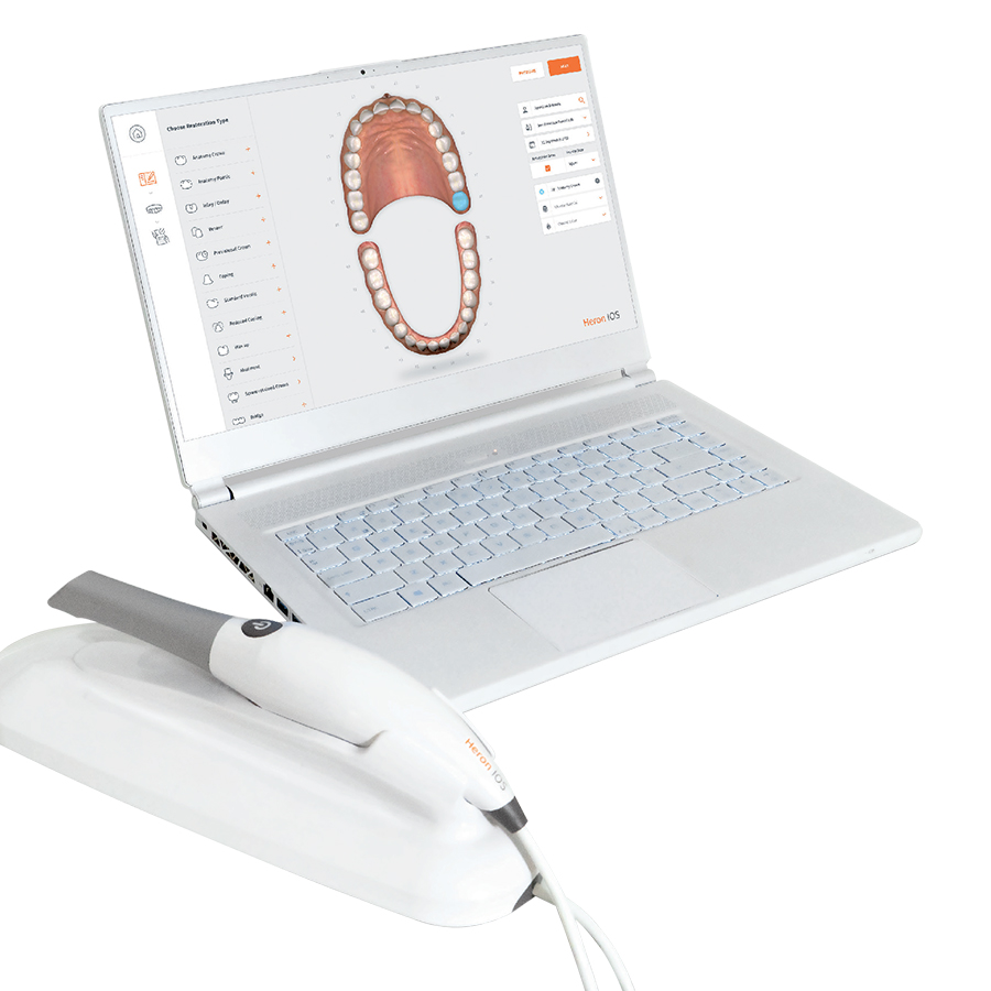 escaner-intraoral-dental