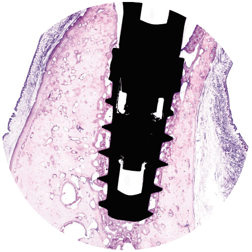 osteointegracion-galimplant-ipx