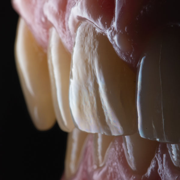 tratamiento-paciente-implantes-dentales