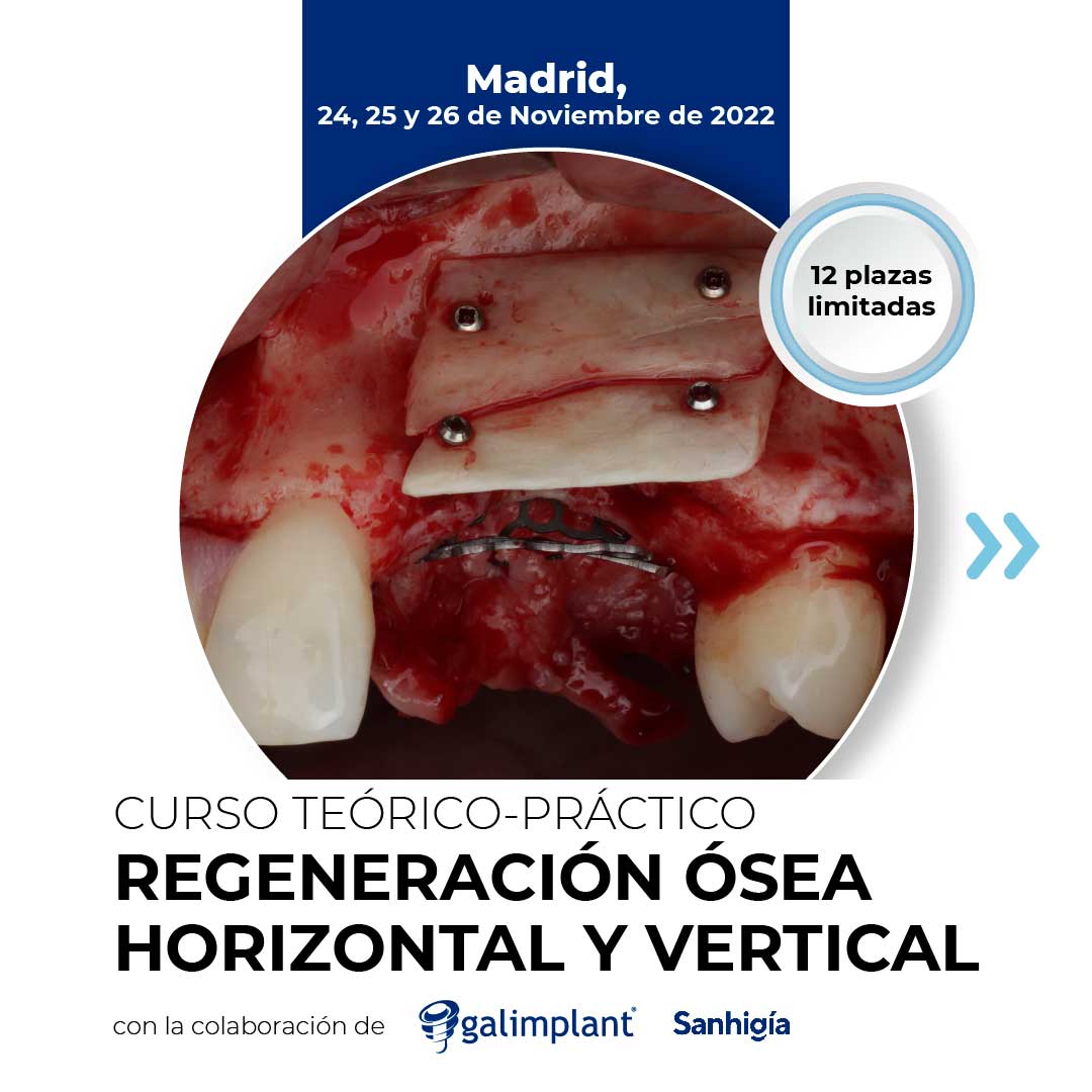 curso de regeneración ósea madrid