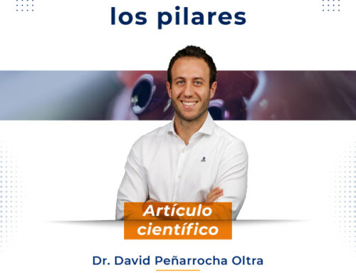 Artículo | La revolución de los pilares