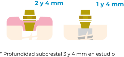 Altura del perfil de emergencia