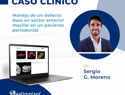 Caso clínico | Manejo de un defecto óseo en sector anterior maxilar en un paciente periodontal