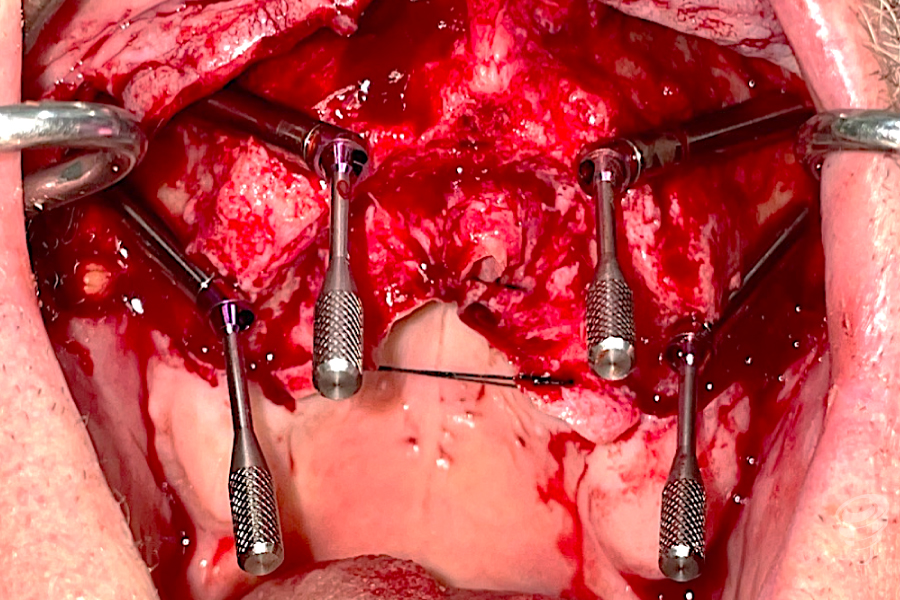 Art.-benito-ramos-38