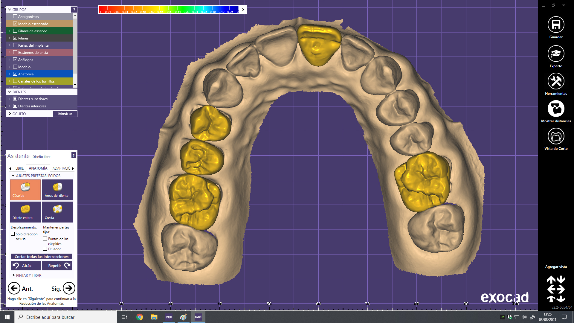 ESTRUCTURAS ANALOGICAS Y DIGITALES-330