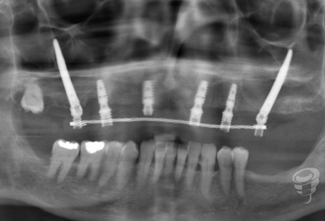 art.-benito-ramos-11