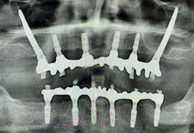 art.-benito-ramos-12