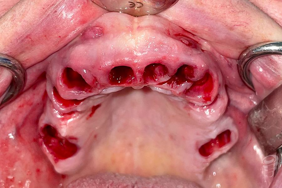 art.-benito-ramos-17