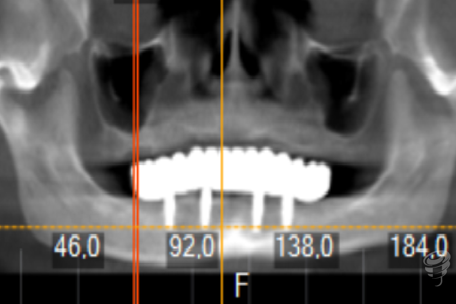 art.-benito-ramos-27