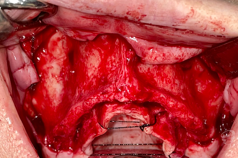 art.-benito-ramos-30