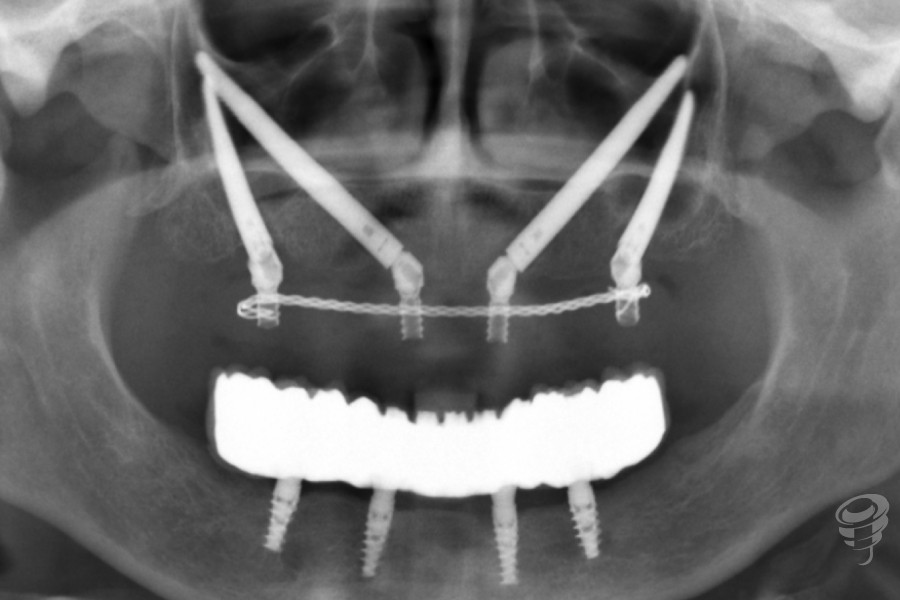 art.-benito-ramos-35