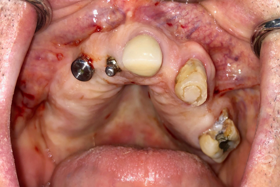 art.-benito-ramos-42