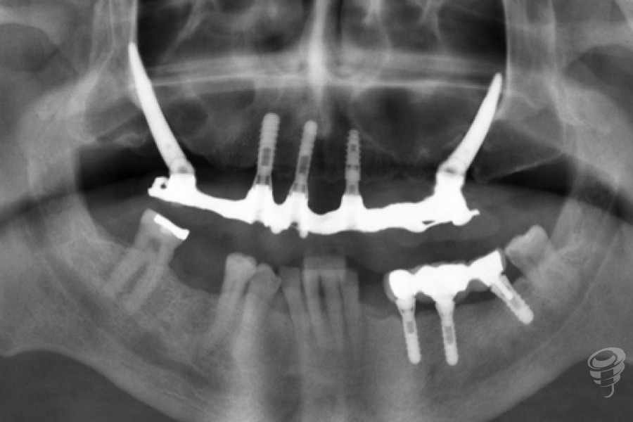 art.-benito-ramos-45