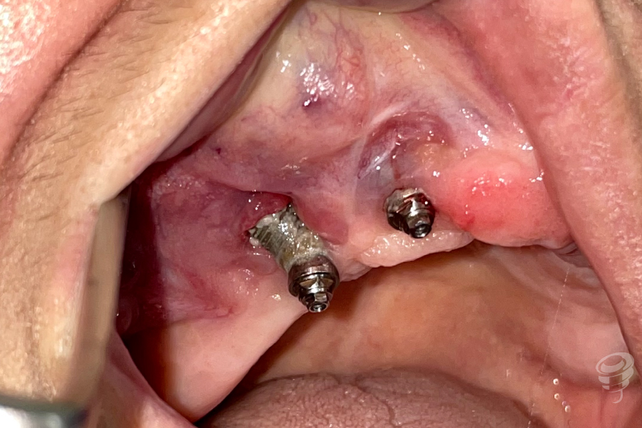 art.-benito-ramos-49