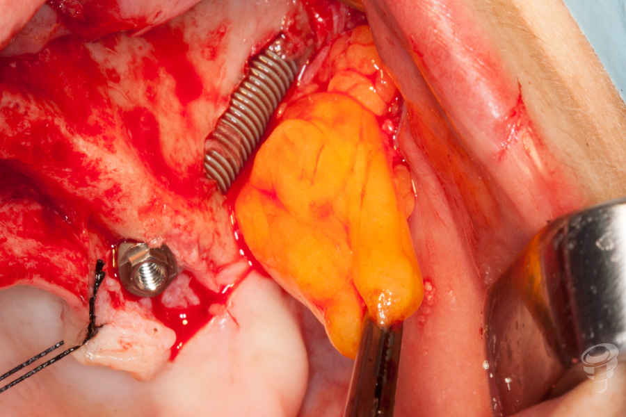 art.-benito-ramos-50