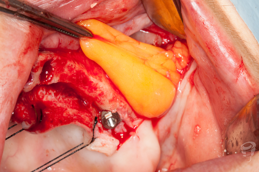 art.-benito-ramos-51