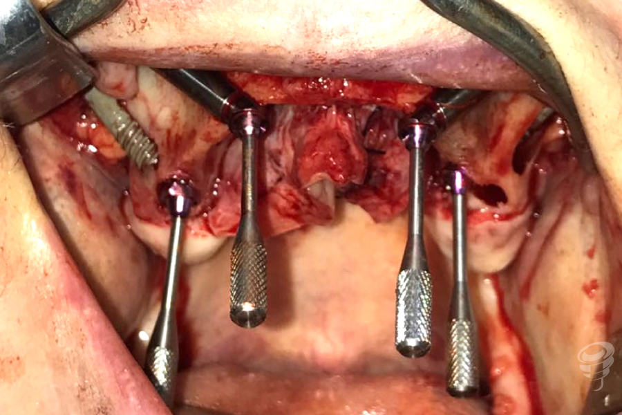 art.-benito-ramos-56