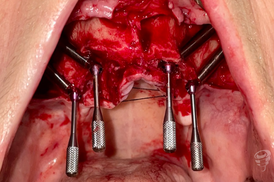 art.-benito-ramos-58