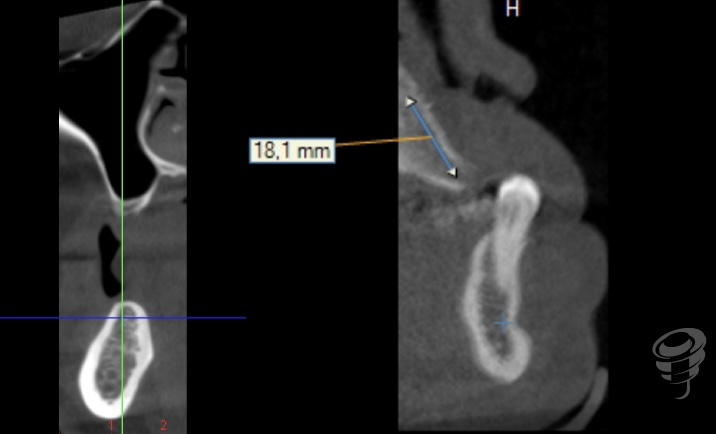 art.-benito-ramos-6-7