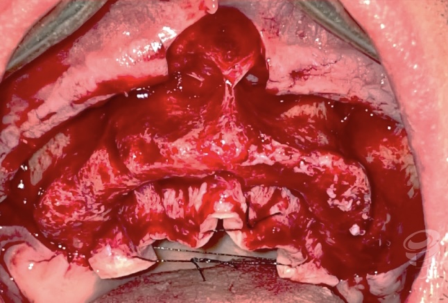 art.-caso-clínico-8