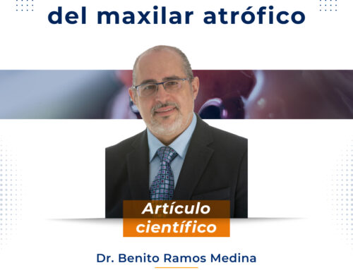 Artículo | La rehabilitación del maxilar atrófico sigue suponiendo un reto clínico