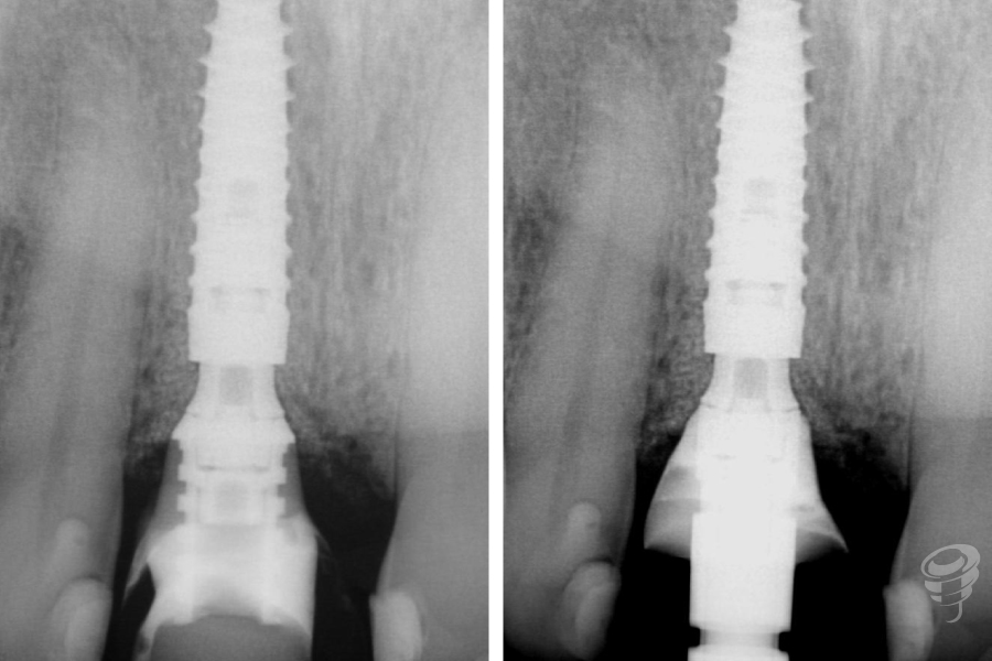 CC-HABIB-CARGA-INMEDIATA-1