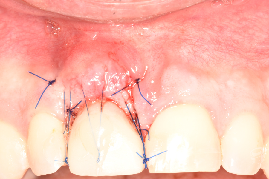 CC-HABIB-CARGA-INMEDIATA-2