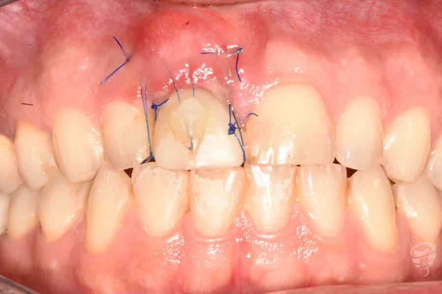 CC-HABIB-CARGA-INMEDIATA-3