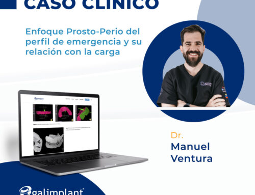 Opinión Experto | Enfoque Prosto-Perio del implante de emergencia