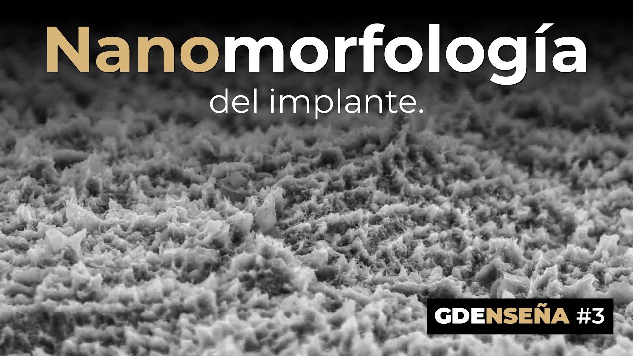 gde enseña 3
