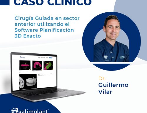 Caso clínico | Cirugía Guiada en sector anterior utilizando el Software de Planificación de Implantes 3D Exacto con máximo compromiso estético